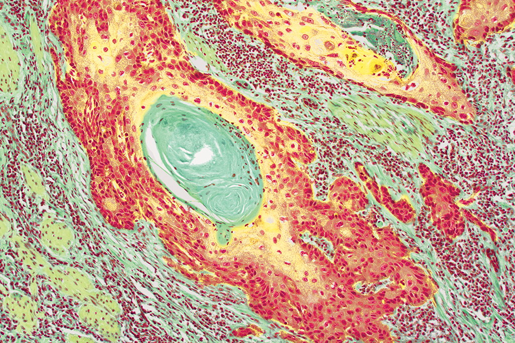 Zoom: sol, sombra e água fresca