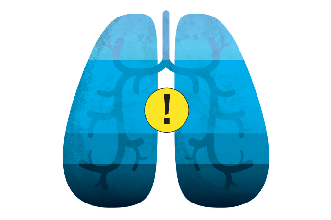 mycoplasma-pneumoniae-como-tratar