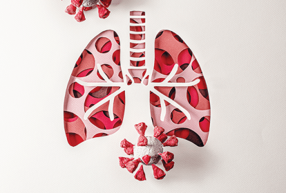 pneumonite-pneumonia-causas