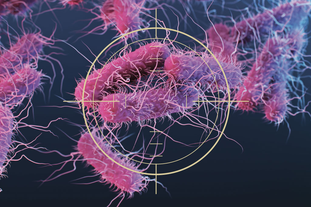 Supermicróbios: guerra na surdina