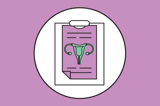 Há cura para endometriose profunda? Tratamentos, sintomas e perspectivas