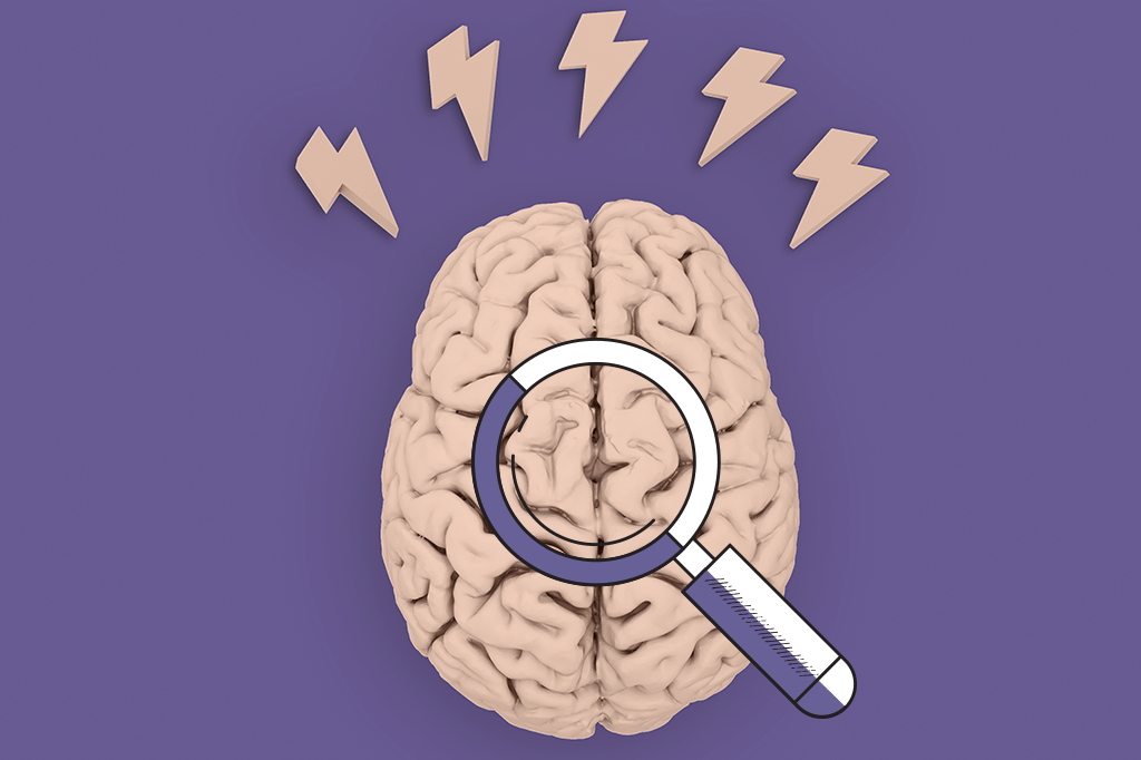 O exame que pode detectar Alzheimer anos antes dos sintomas