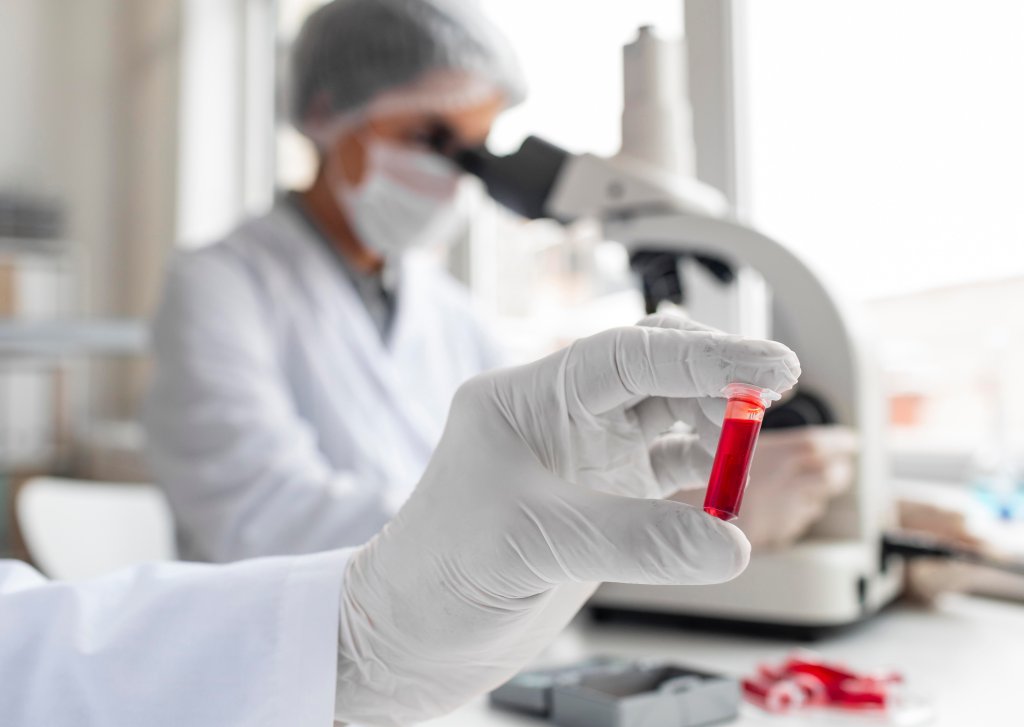 Antibiograma: o que é e para que serve esse exame