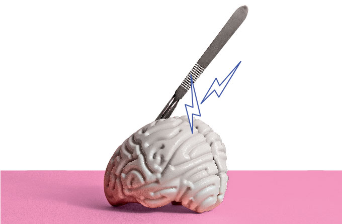 Uma vida com enxaqueca: “não suportava ouvir qualquer ruído”