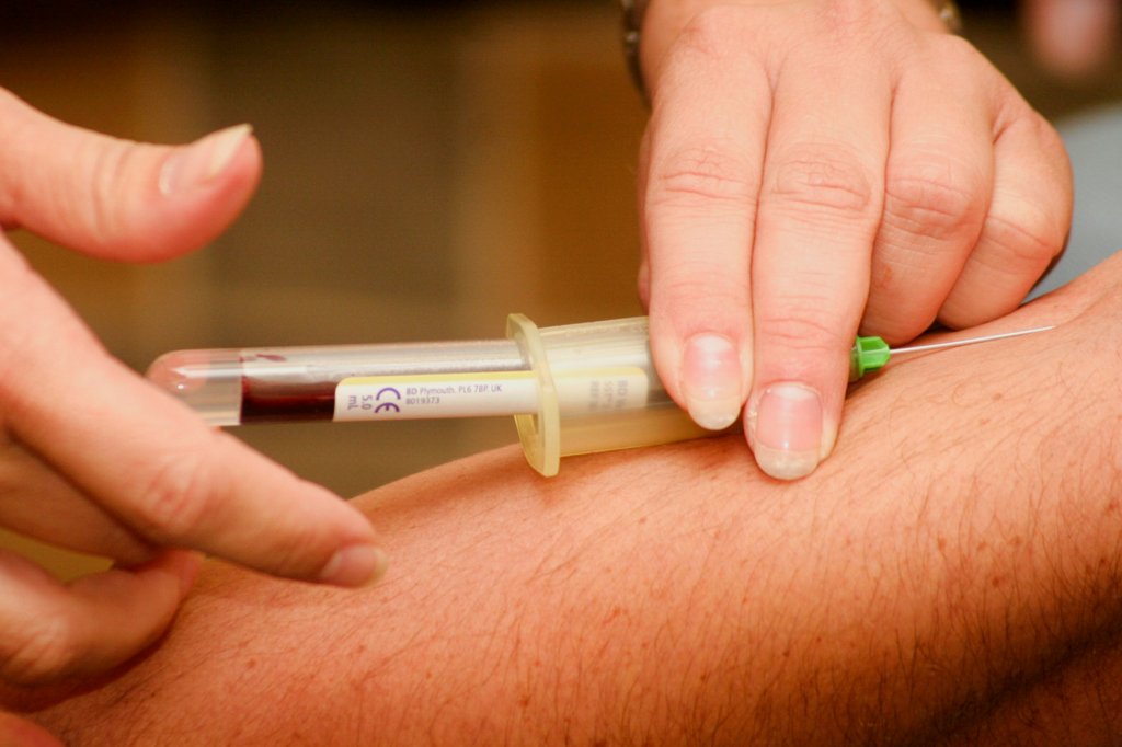 saude-medicina-virus-htlv saude-medicina-virus-htlv