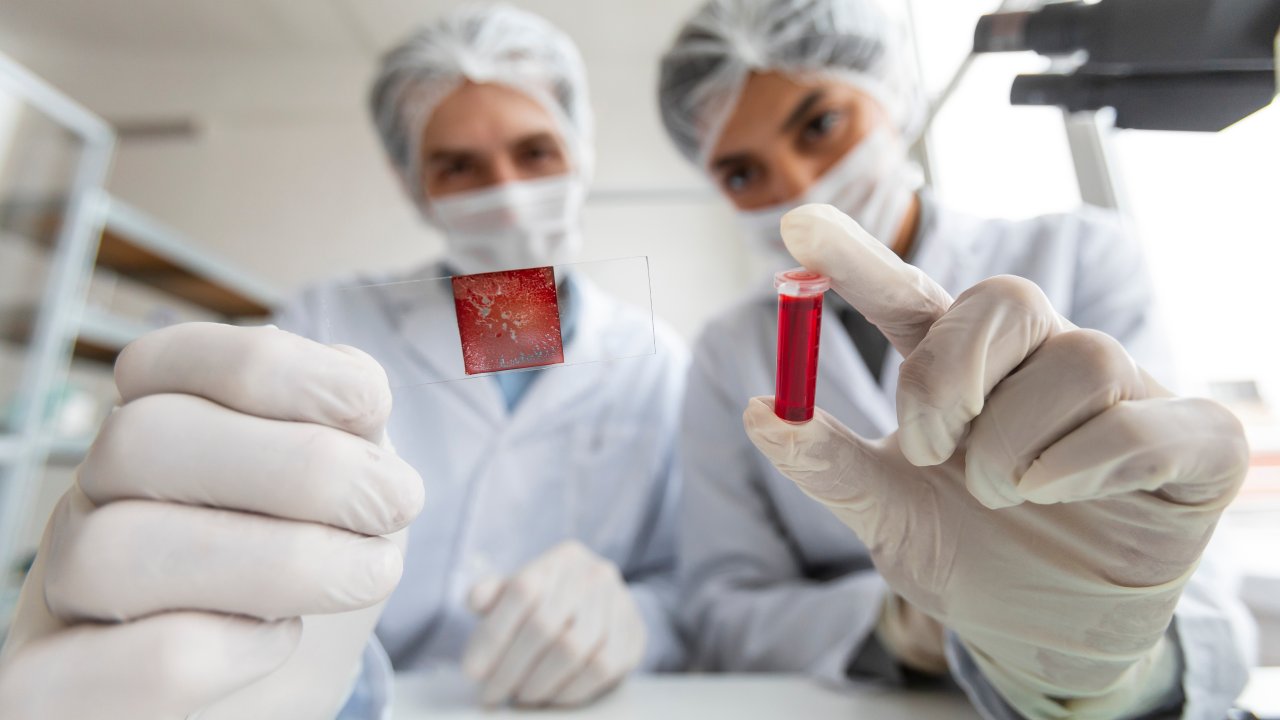 fosfatase-alcalina-para-que-serve-exame-figado-ossos
