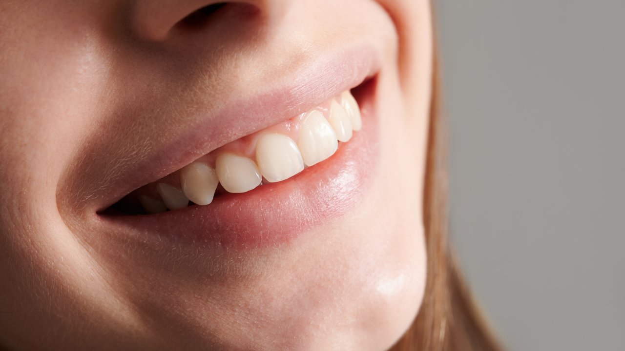 gengivoplastia-como-funciona-cirurgia-plastica-das-gengivas-hiperplasia-retracao-gengival