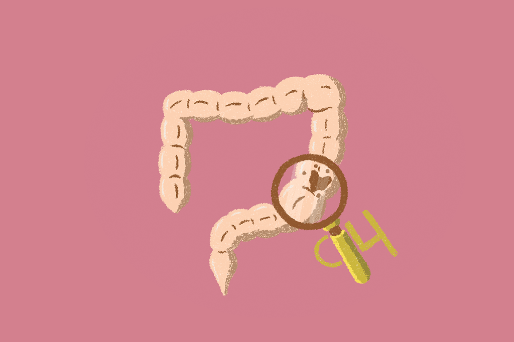 Câncer colorretal em jovens e idosos: o mesmo nome para duas doenças?