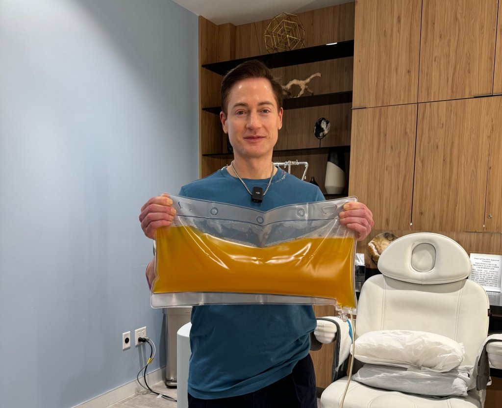 Para não envelhecer, magnata troca o plasma do corpo por proteína