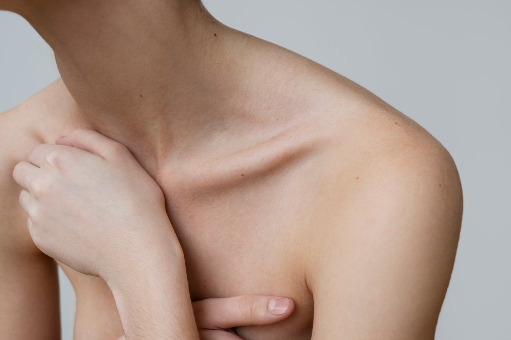 Candidíase cutânea: saiba como evitar e tratar esse problema