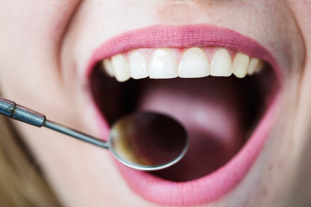 Cor do dente e a saúde bucal? Qual a relação entre elas?