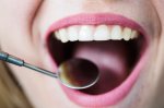Cor do dente e a saúde bucal? Qual a relação entre elas? medicamento-crescer-dentes-japao