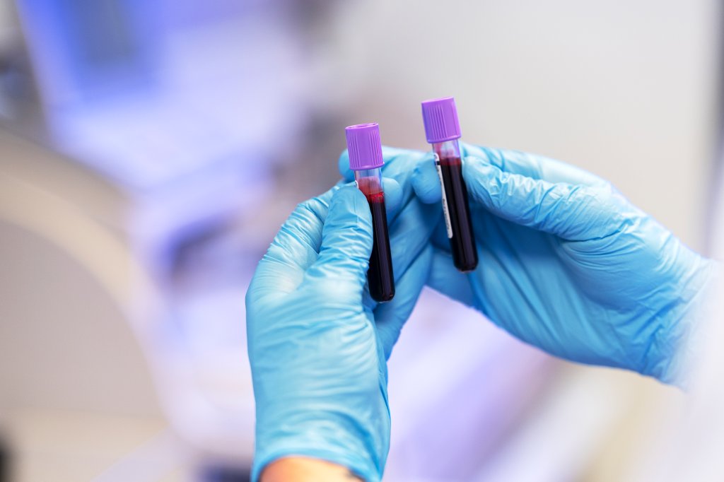 Eritrócitos altos no exame de sangue: entenda possíveis causas