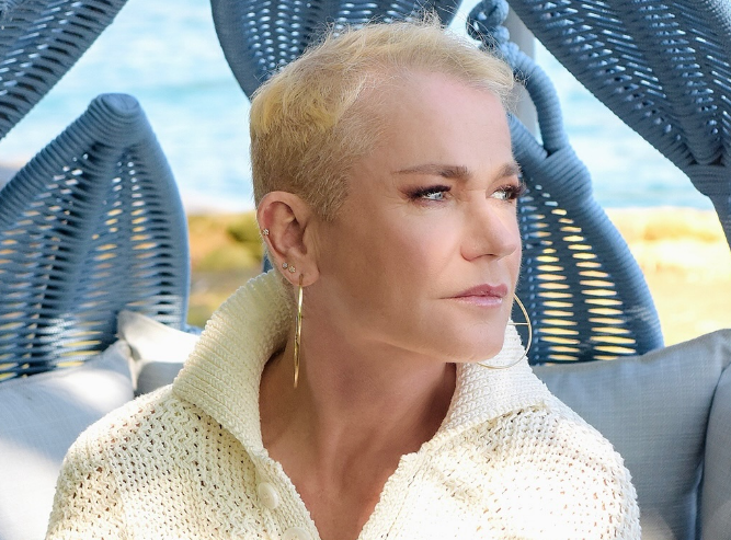 Alopecia androgenética: saiba mais sobre a condição que afeta Xuxa