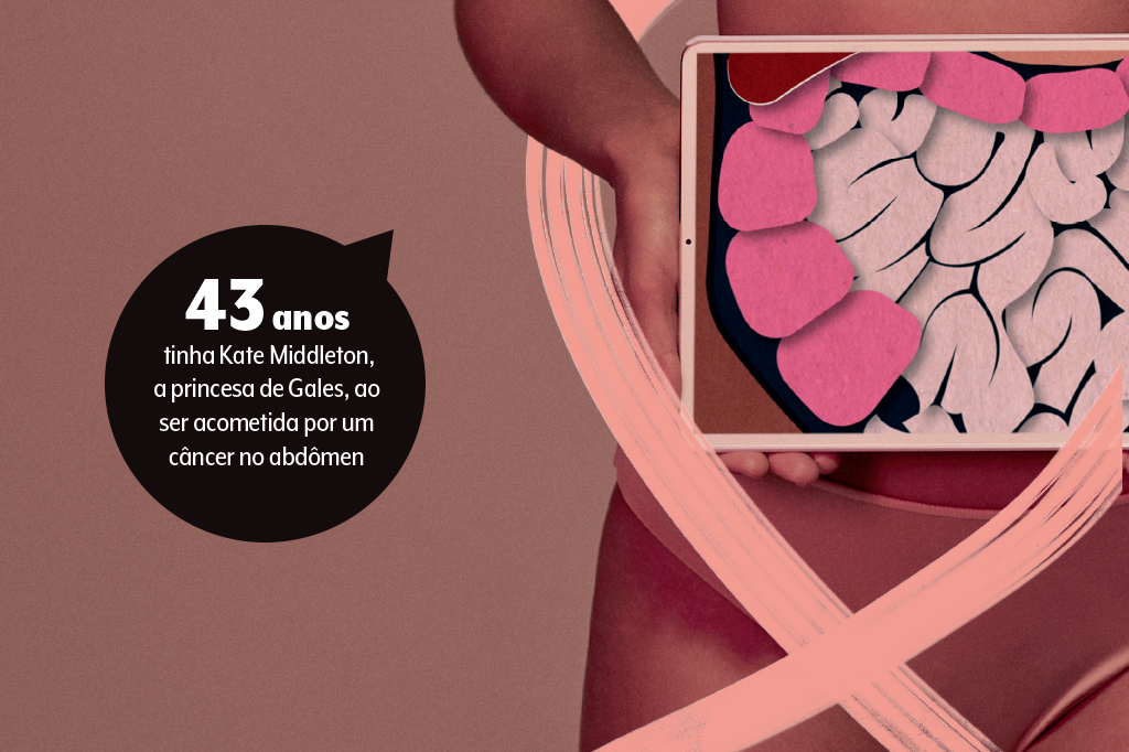 cancer-abdomen cancer-abdomen