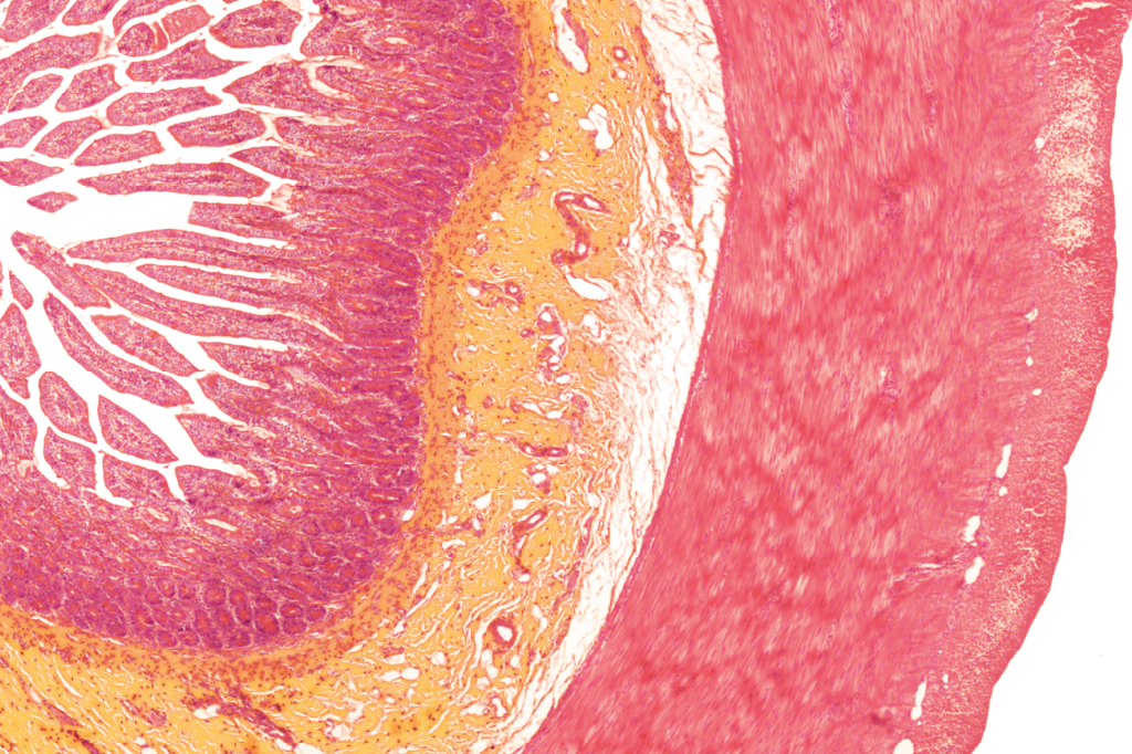 intestino-delgado