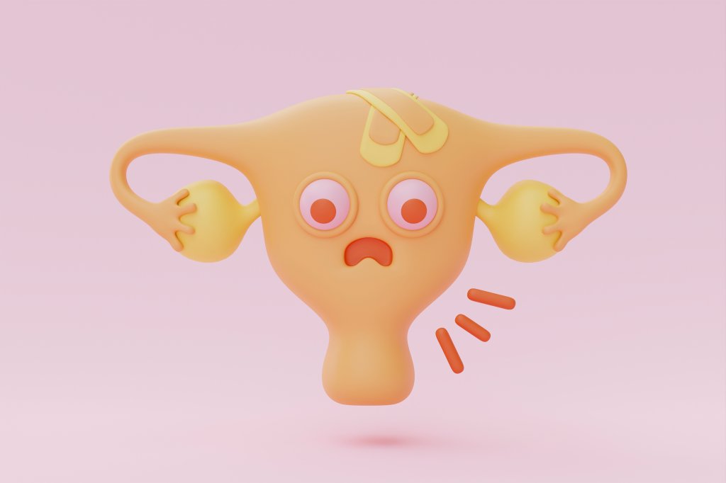 Adenomiose: o que é, quais são os sintomas, causas e tratamentos