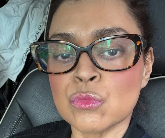 Preta Gil: entenda o tratamento experimental feito pela artista nos EUA