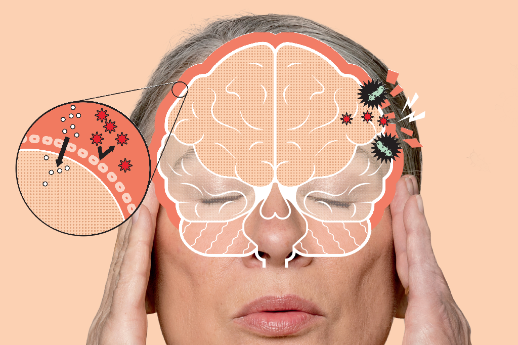 barreira-hematoencefalica