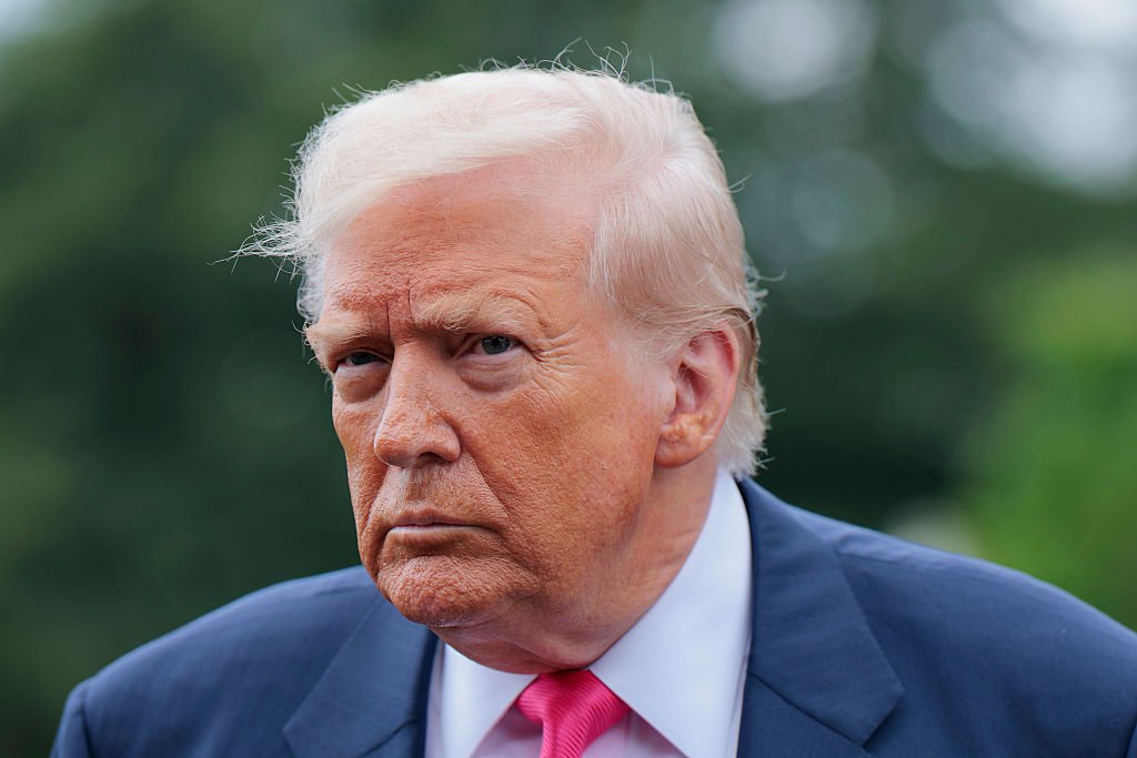 Doença circulatória de Trump é comum e muitas vezes negligenciada