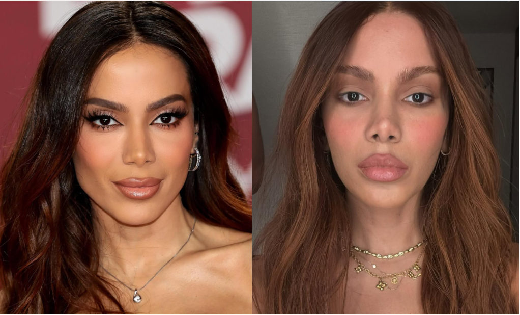 Facelift na faixa dos 30 anos: é recomendado? 