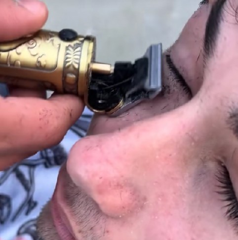 Raspar os cílios faz mal? Entenda riscos de tendência do TikTok