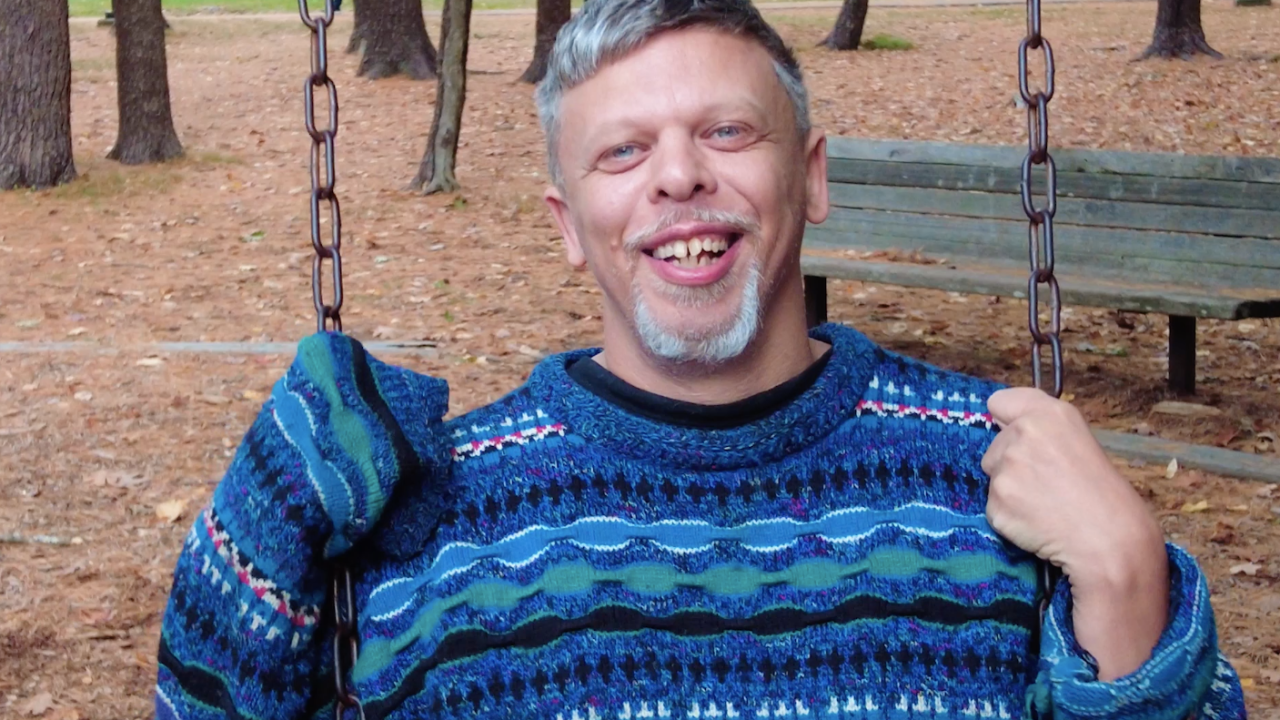 sindrome-de-williams-josh-duffy