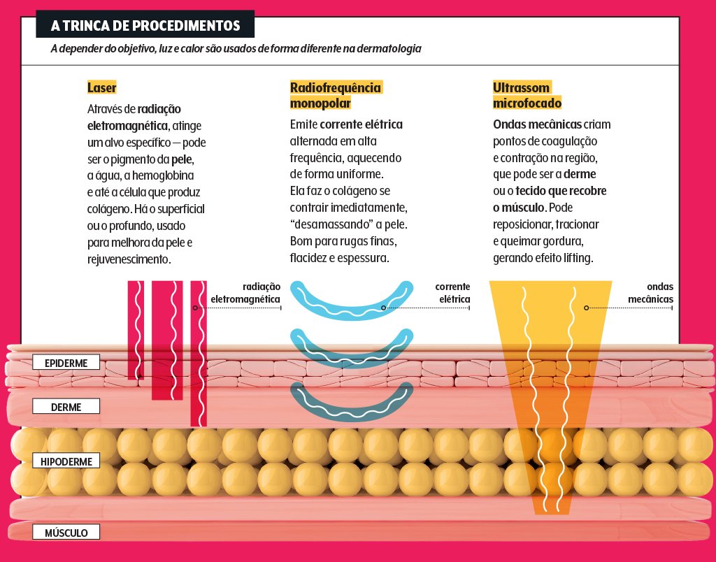 tecnologias-dermatologicas-diferencas