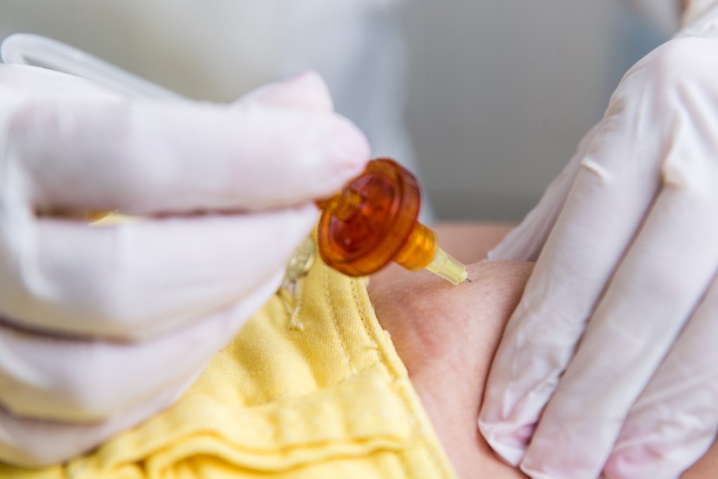 Carboxiterapia: o que é a técnica e quais as indicações