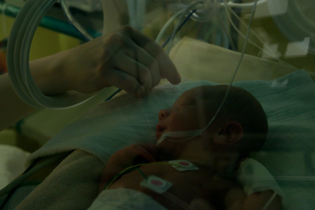 Dificuldade respiratória: quando um recém-nascido precisa da UTI neonatal?