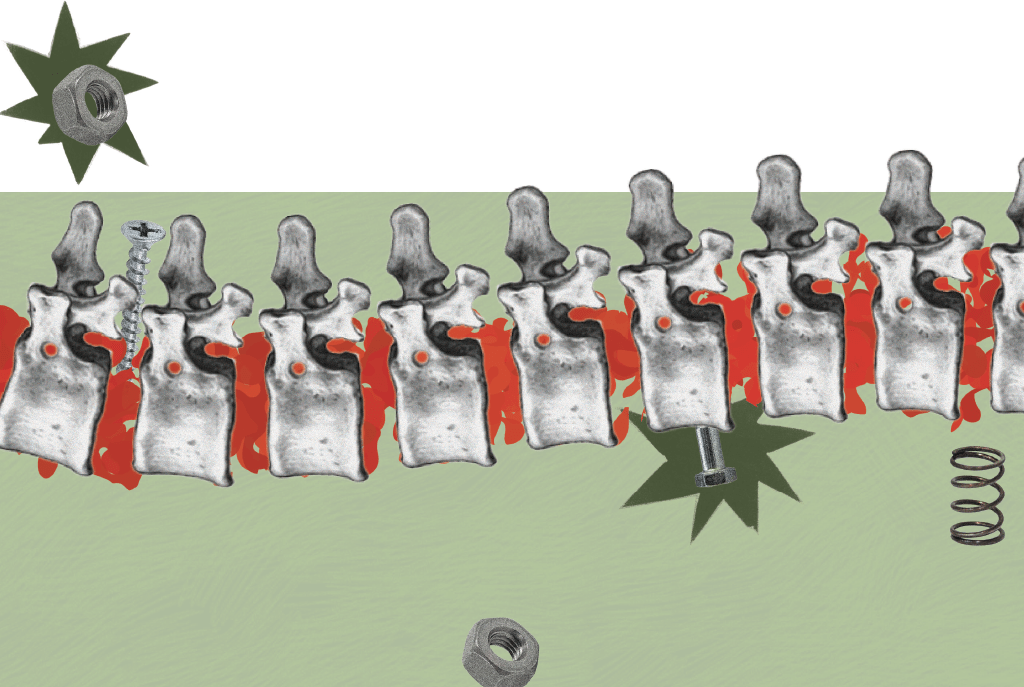 O sonho caminha: a polilaminina e outras apostas contra a lesão medular