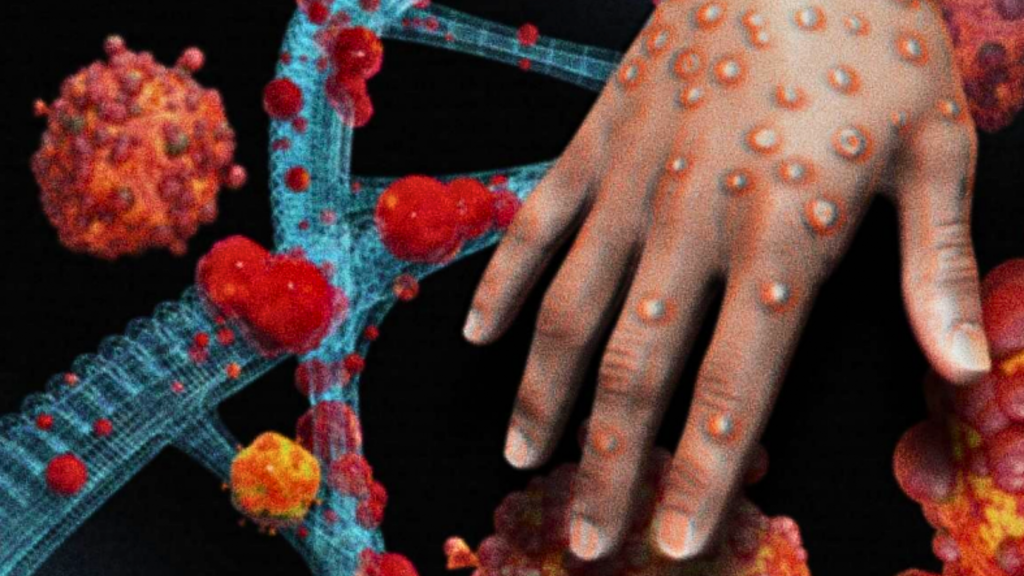 Aprenda a identificar as lesões do mpox e o que fazer se notar sintomas