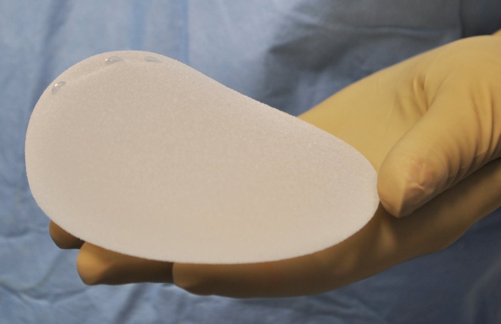 Implante de silicone na mama pode causar linfoma? Entenda caso de influencer que descobriu câncer