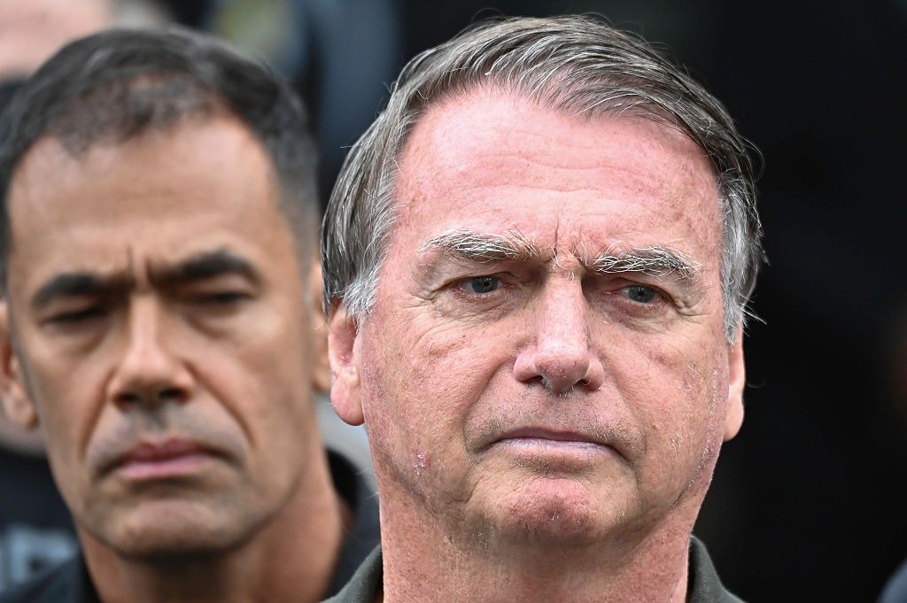 Broncopneumonia: quadro de Bolsonaro é grave? Entenda internação do ex-presidente