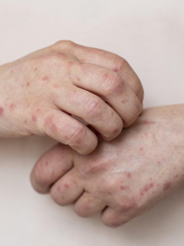 cropped-skin-allergy-person-s-arm.jpg