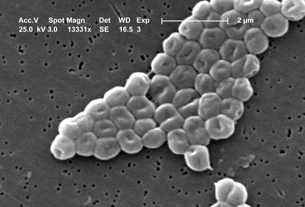 O que é acinetobacter? Superbactéria perigosa é encontrada em água de Porto Alegre