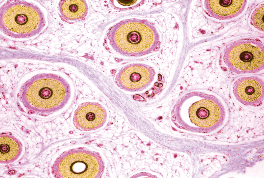 De onde saem os pelos do corpo? Superzoom revela detalhes impressionantes dessas estruturas