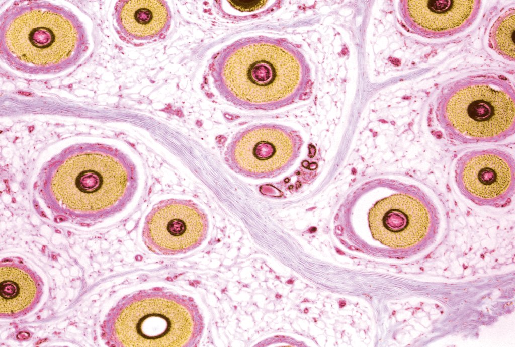 De onde saem os pelos do corpo? Superzoom revela detalhes impressionantes dessas estruturas