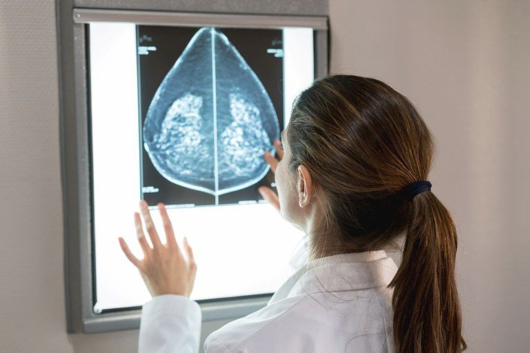 Mamografia digital sem restrição de idade pode entrar na cobertura obrigatória dos planos