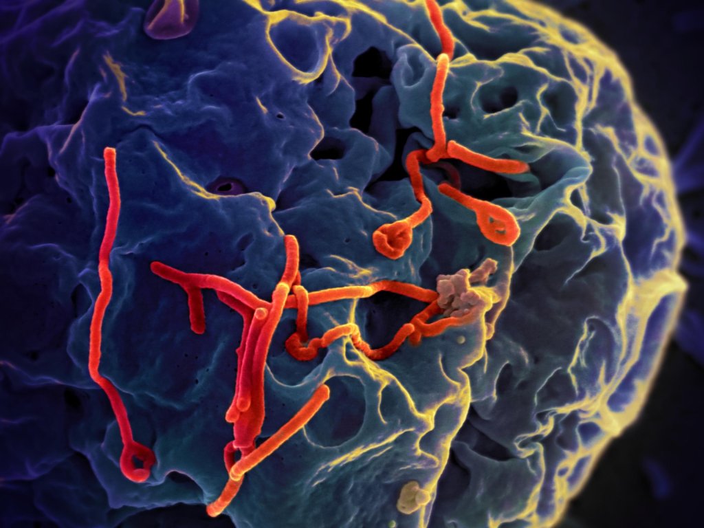 Ebola no Brasil: o que se sabe sobre os casos suspeitos investigados no país
