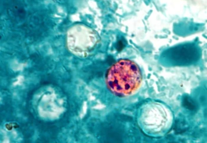 Microscopia mostrando um oocisto esférico rosa-avermelhado com pontos escuros e outros oocistos translúcidos em fundo azul-esverdeado