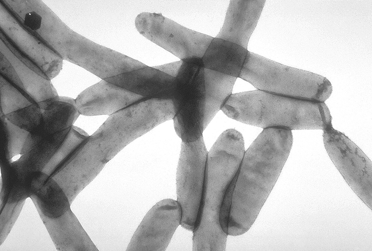 Micrografia eletrônica em tons de cinza mostrando filamentos alongados de bactérias ou fungos, alguns se cruzando e outros se conectando, com áreas mais escuras indicando maior densidade ou sobreposição, sobre um fundo branco