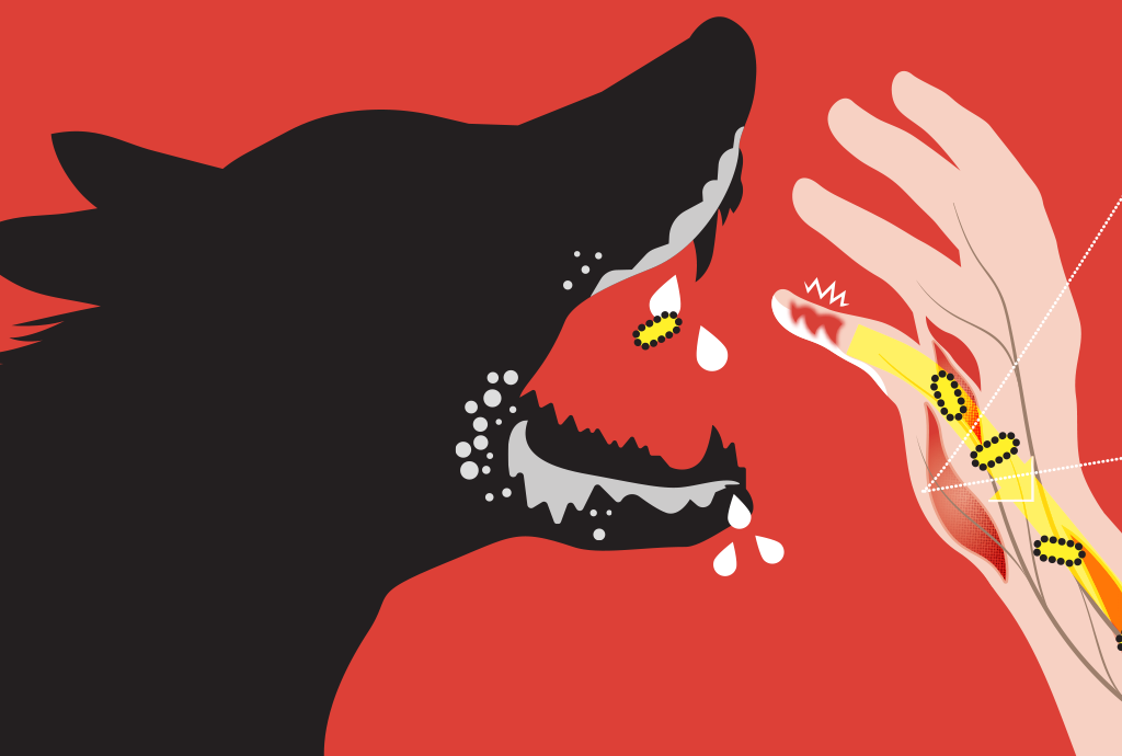 Ilustração de um lobo preto raivoso com a boca aberta, salivando e com dentes afiados, mordendo o dedo indicador de uma mão humana. A mão tem nervos expostos e pontos pretos que representam bactérias, com um fundo vermelho