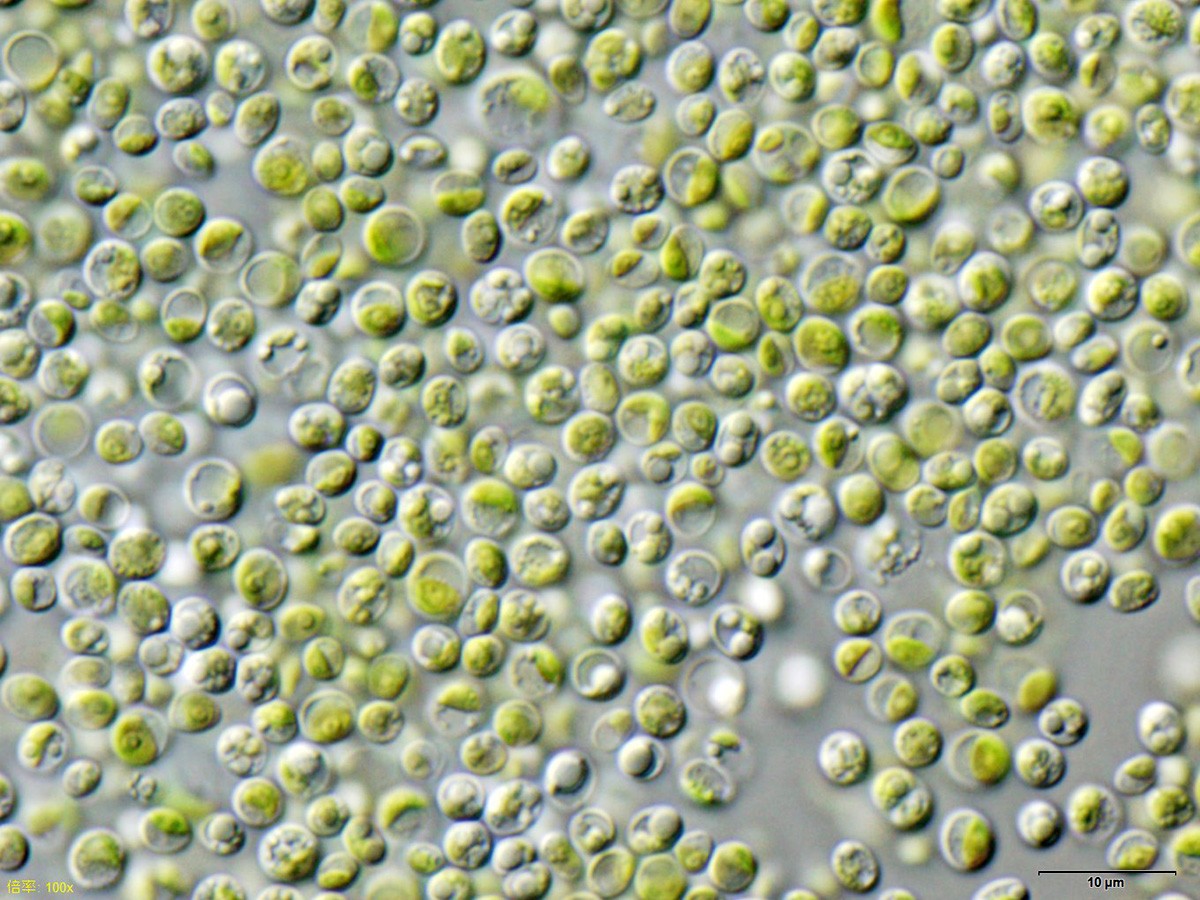 Chlorella: o que a ciência diz sobre a “superalga” que promete bombar sua saúde