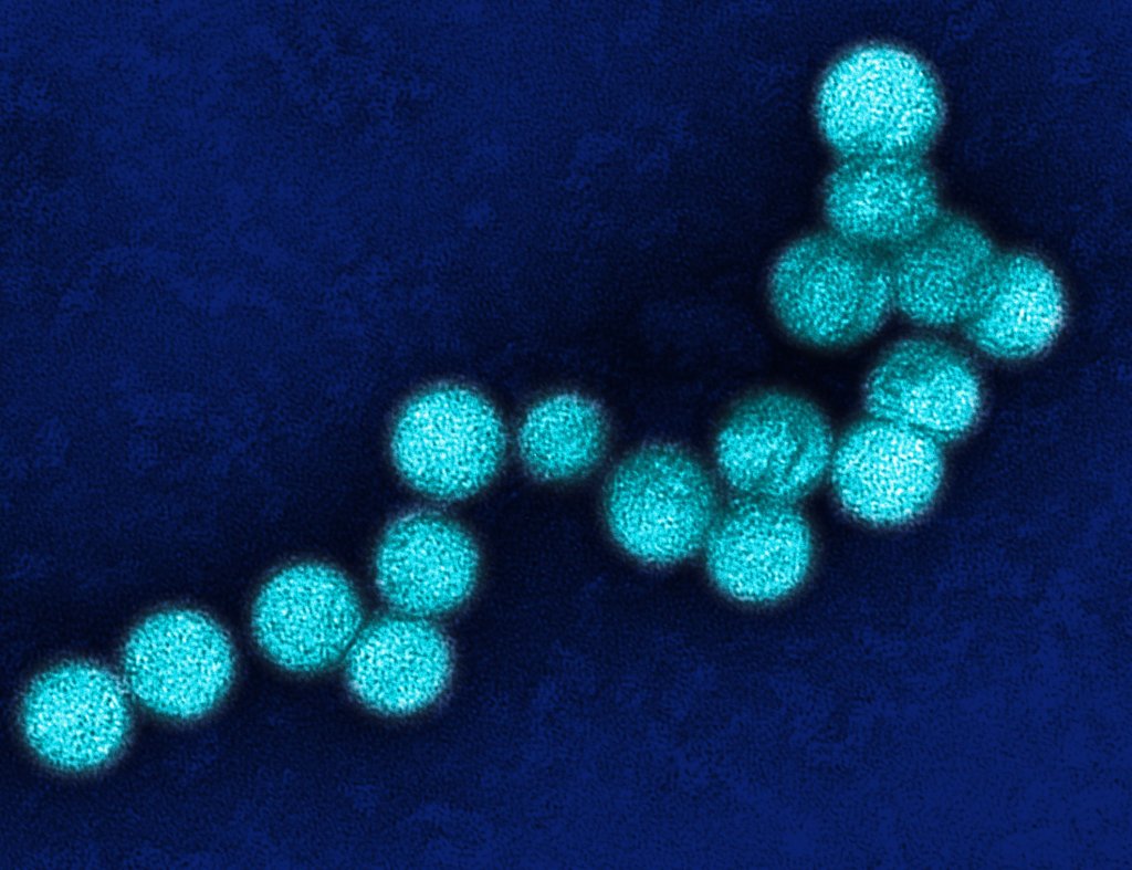 virus-do-oeste-do-nilo